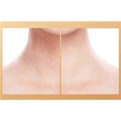 Коллагеновый патч для шеи JomTam Hexapeptide Collagen Neck Mask, 1 штука 30 гр.